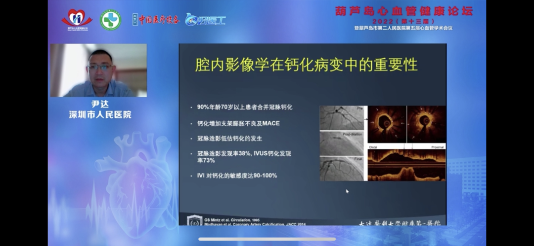 葫蘆島心血管健康論壇?2022｜創新驅動發展，不斷提升心血管疾病救治能力(圖11)